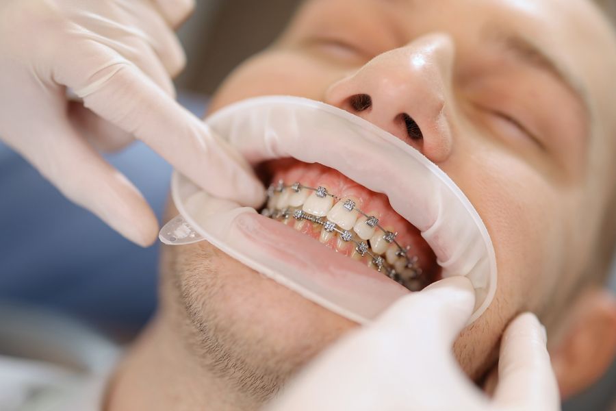 orthodontie et traitement de santé